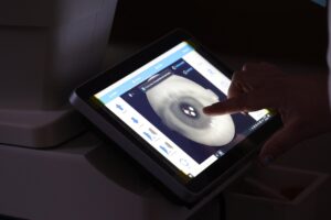 “Doctors Operated During the Day, and Trained Our Algorithm at Night.” How CheckEye Works